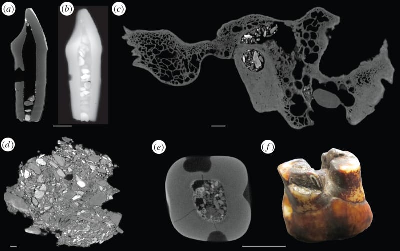 Images scientifiques révélant du gravier introduit dans les cavités des restes de Piltdown