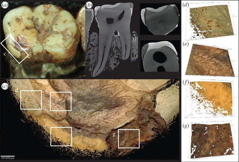Vues microscopiques et tomographiques des modifications artificielles d’une dent de Piltdown